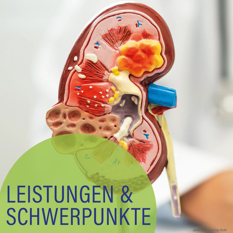 Farbiges 3D-Modell einer menschlichen Niere. Hellgrüner Kreis mit der Aufschrift Leistungen und Schwerpunkte.