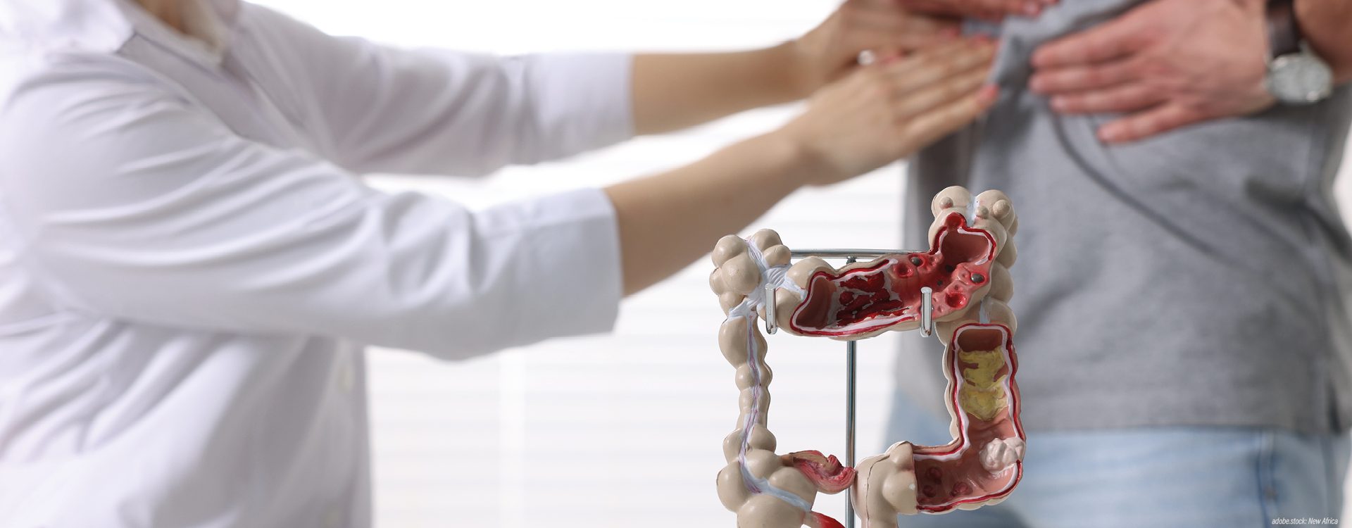 Zwei Hände untersuchen den Bauchbereich eines Patienten, im Vordergrund ein 3D-Modell des menschlichen Darms.