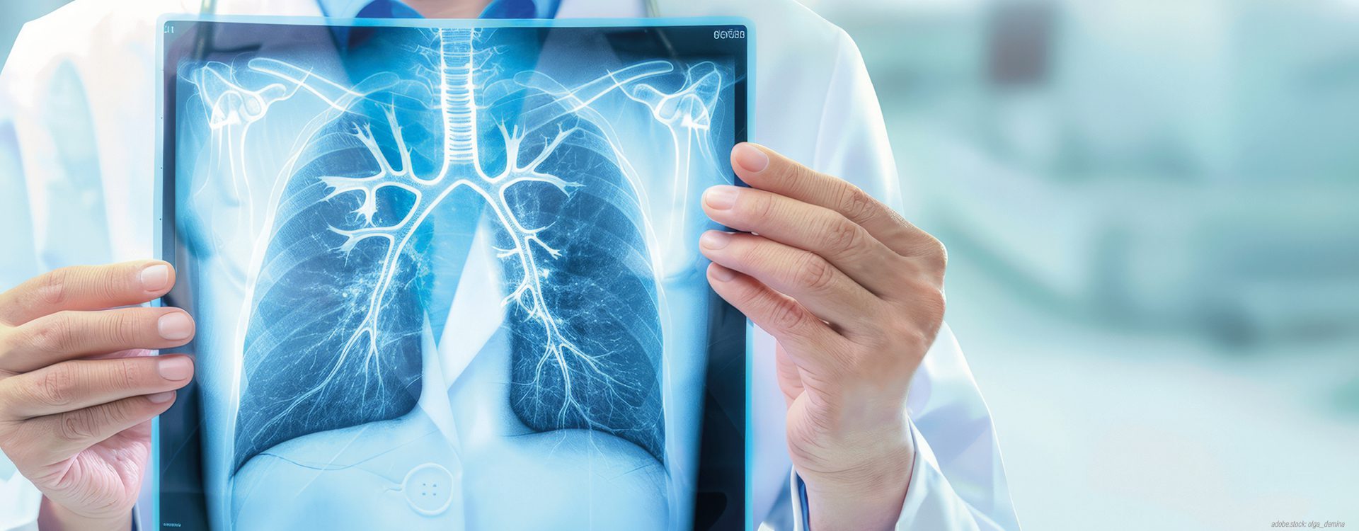Eine Person in weißer Arbeitskleidung hält ein Röntgenbild der menschlichen Lunge.