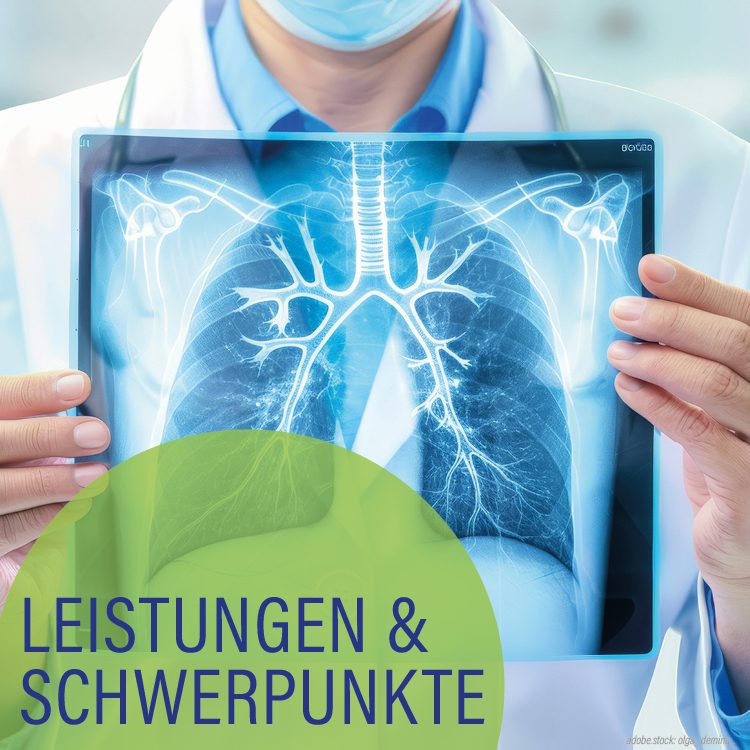 Eine Person in weißer Arbeitskleidung hält ein Röntgenbild der menschlichen Lunge. Hellgrüner Kreis mit der Aufschrift Leistungen und Schwerpunkte.